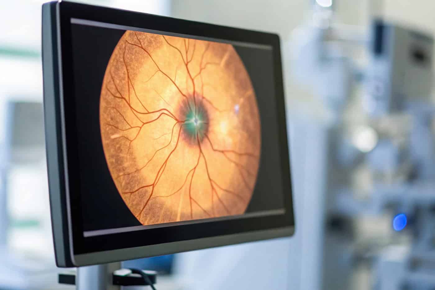 Diabetic Eye Exams