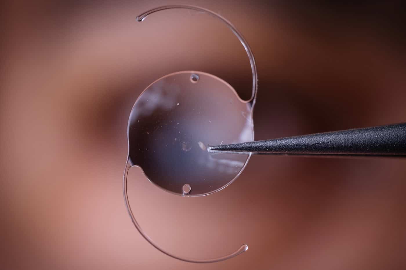 iOL Cataract Treatment